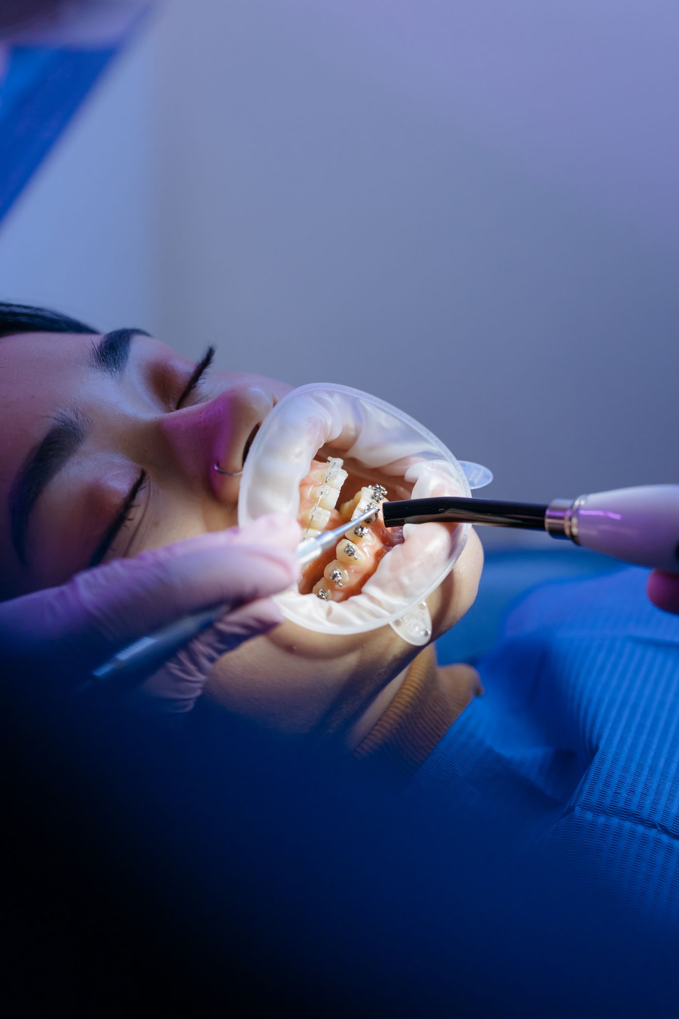 Diş eti hastalıkları için klinik muayene uygulaması